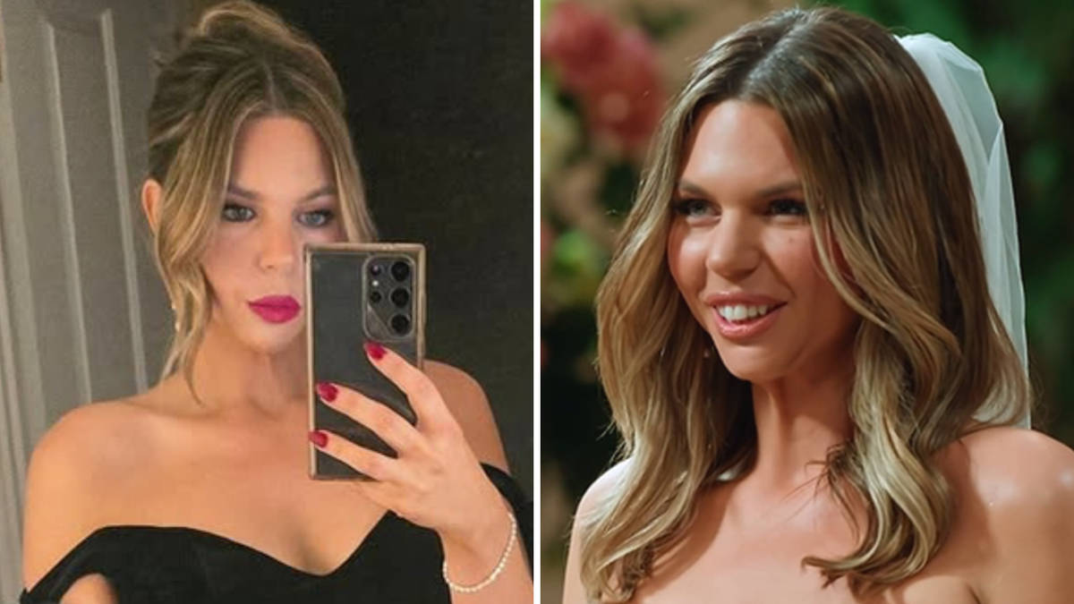 MAFS Bec Zacharia: Hiding Her Jaw Defect Before Surgery